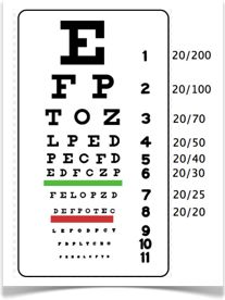 Examen de Salud Visual para detectar enfermedades en los ojos y errores de refracción, estudios de salud visual previos a la corrección visual con láser y a la operación de cataratas